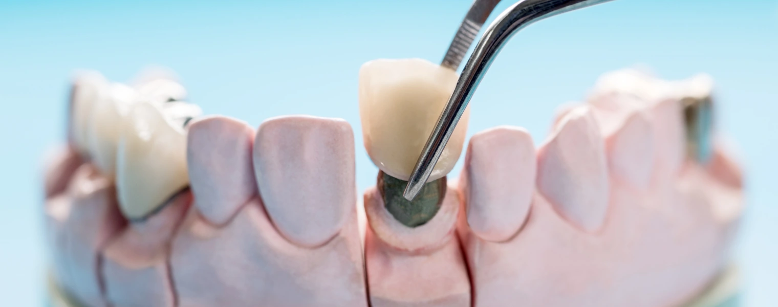 prosthodontics
