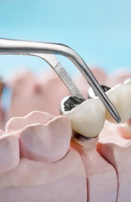 prosthodontic (1)